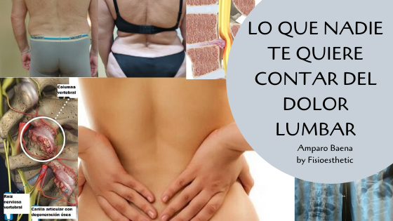 Lo que nadie te quiere contar del dolor lumbar crónico