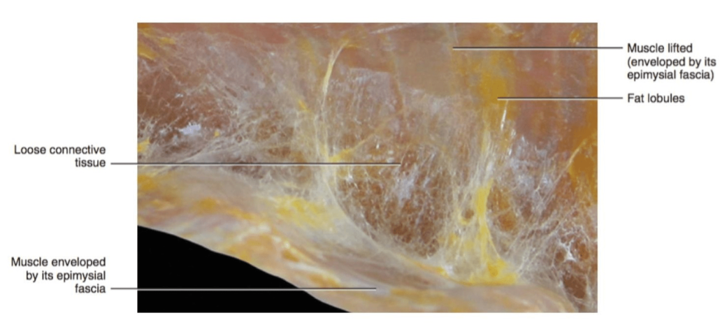 Tejido conectivo fascial